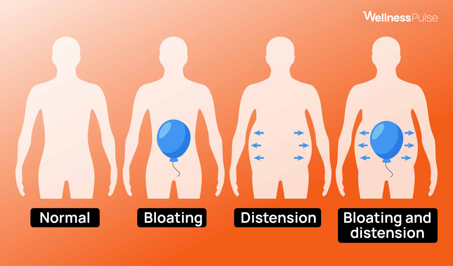 Infographic showing abdominal bloating types, including normal, distension, and more