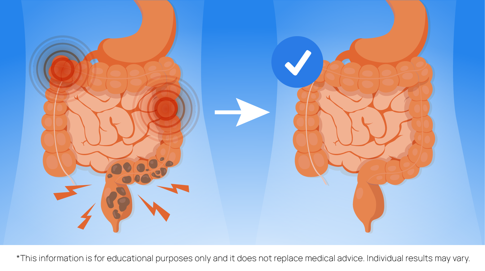 Infographic showing how probiotics improve IBS