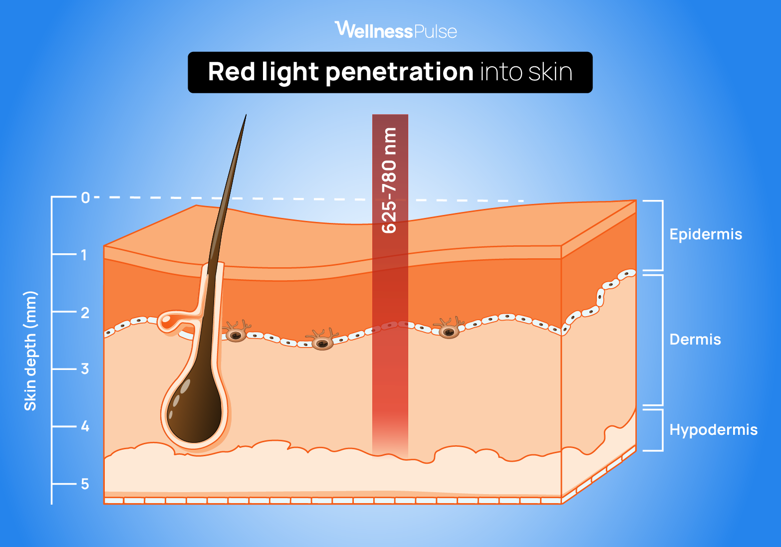 Illustration showing how RLT penetrates the skin