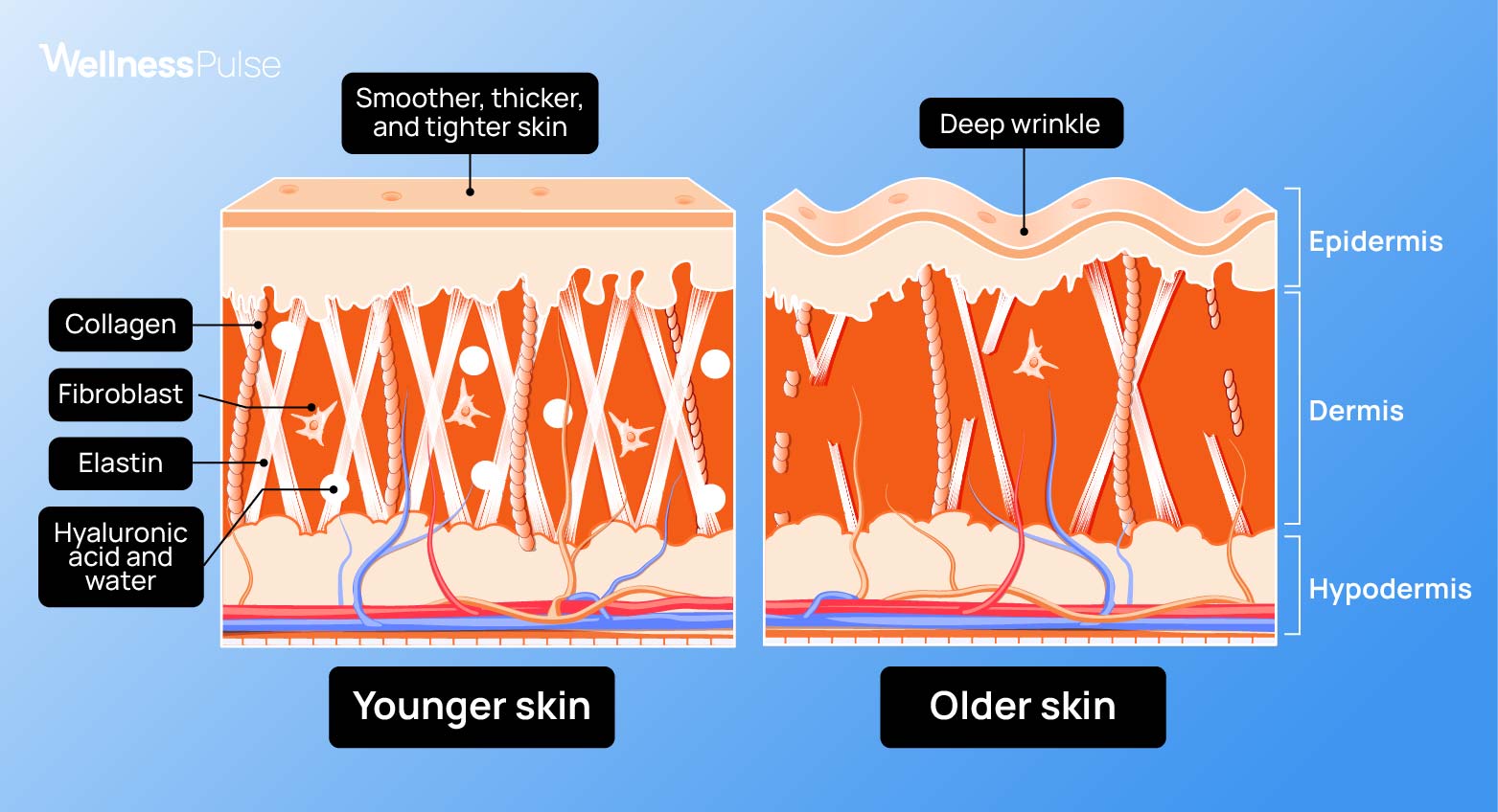 What is collagen