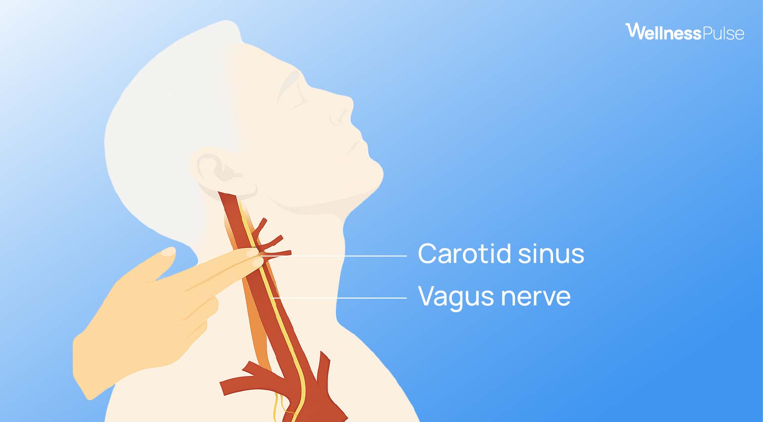 Carotid sinus