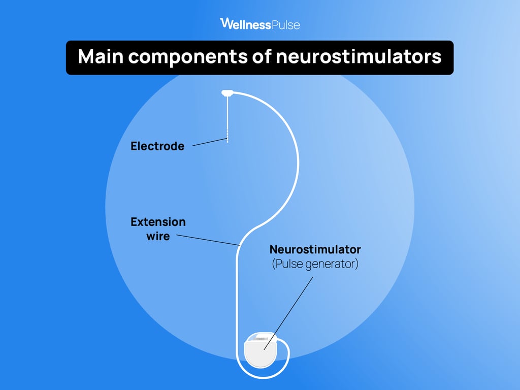 Illustration showing how neurostimulators work and their main components