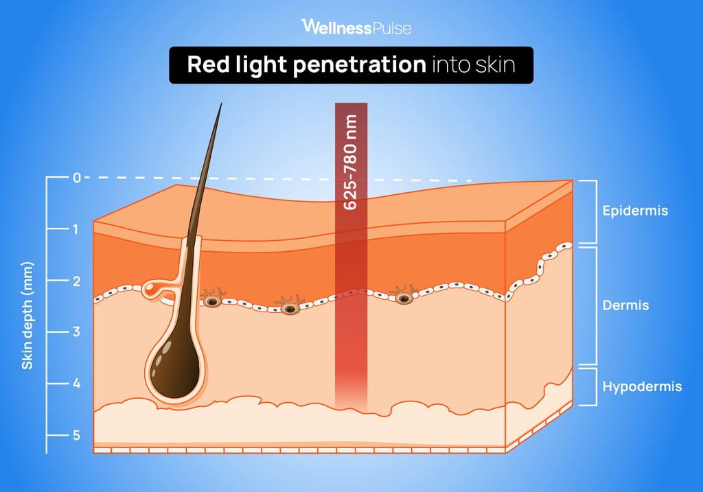 Illustration showing how RLT penetrates the skin