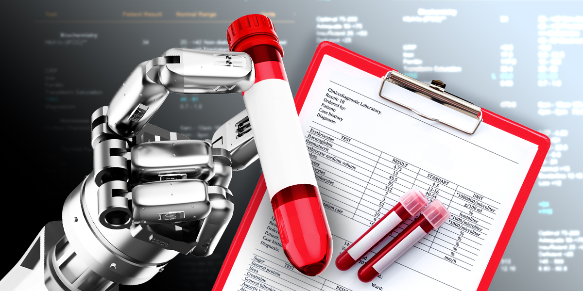 Robotic hand holding a blood vial with its details on a document with data grey background