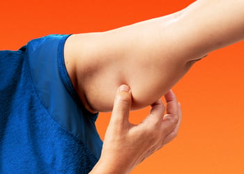 Person with Flabby arms